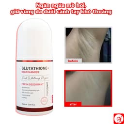 LĂN KHỬ MÙI ANGEL GLUTA 60ML