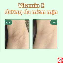 LĂN KHỬ MÙI ANGEL GLUTA 60ML