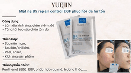 MẶT NẠ B5 REPAIR CONTROL EGF