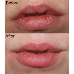 TẨY TBC MÔI BEAUTY TREATS LIP SCRUB
